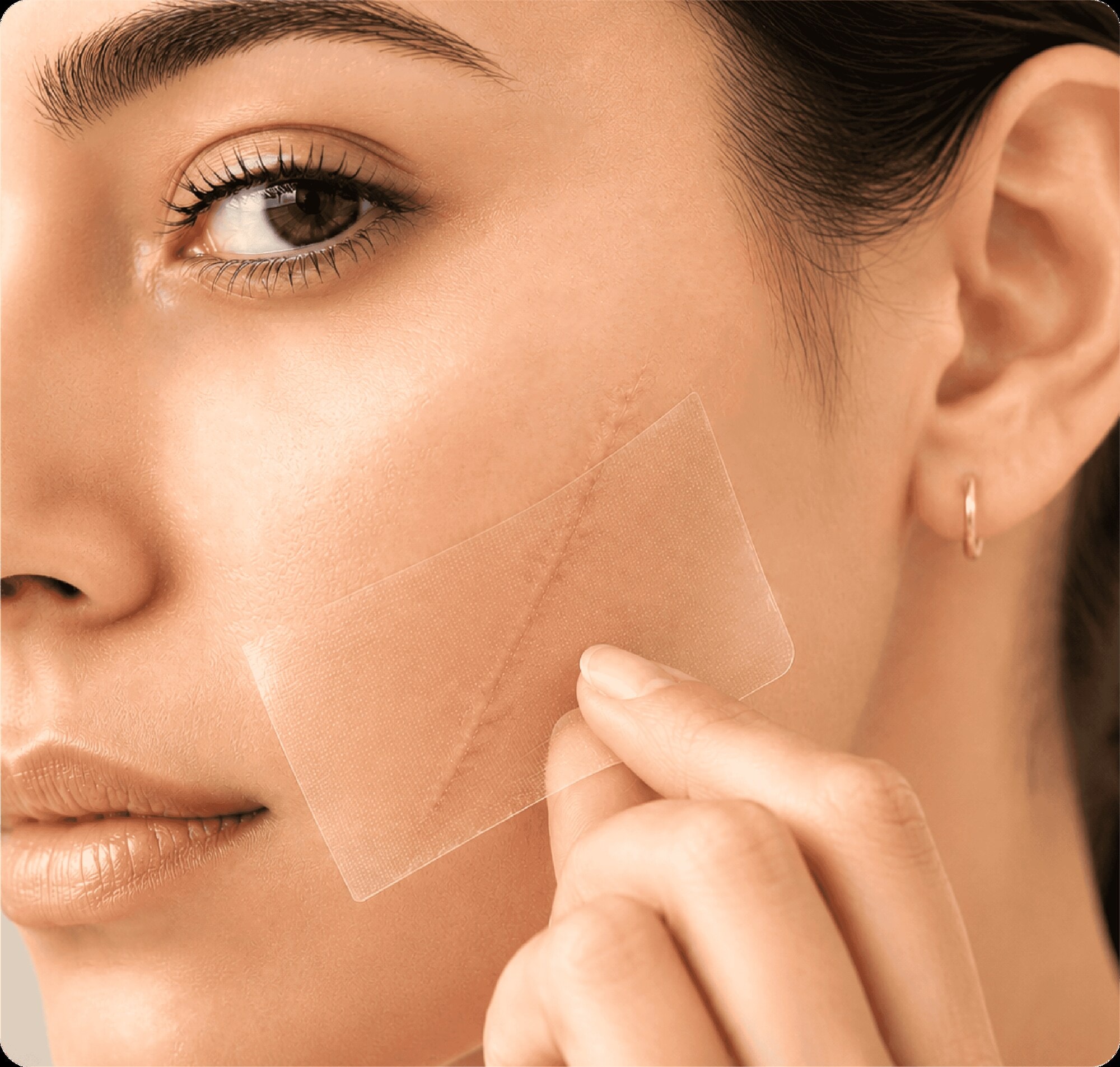 Clarskin customer applying a scar sheet