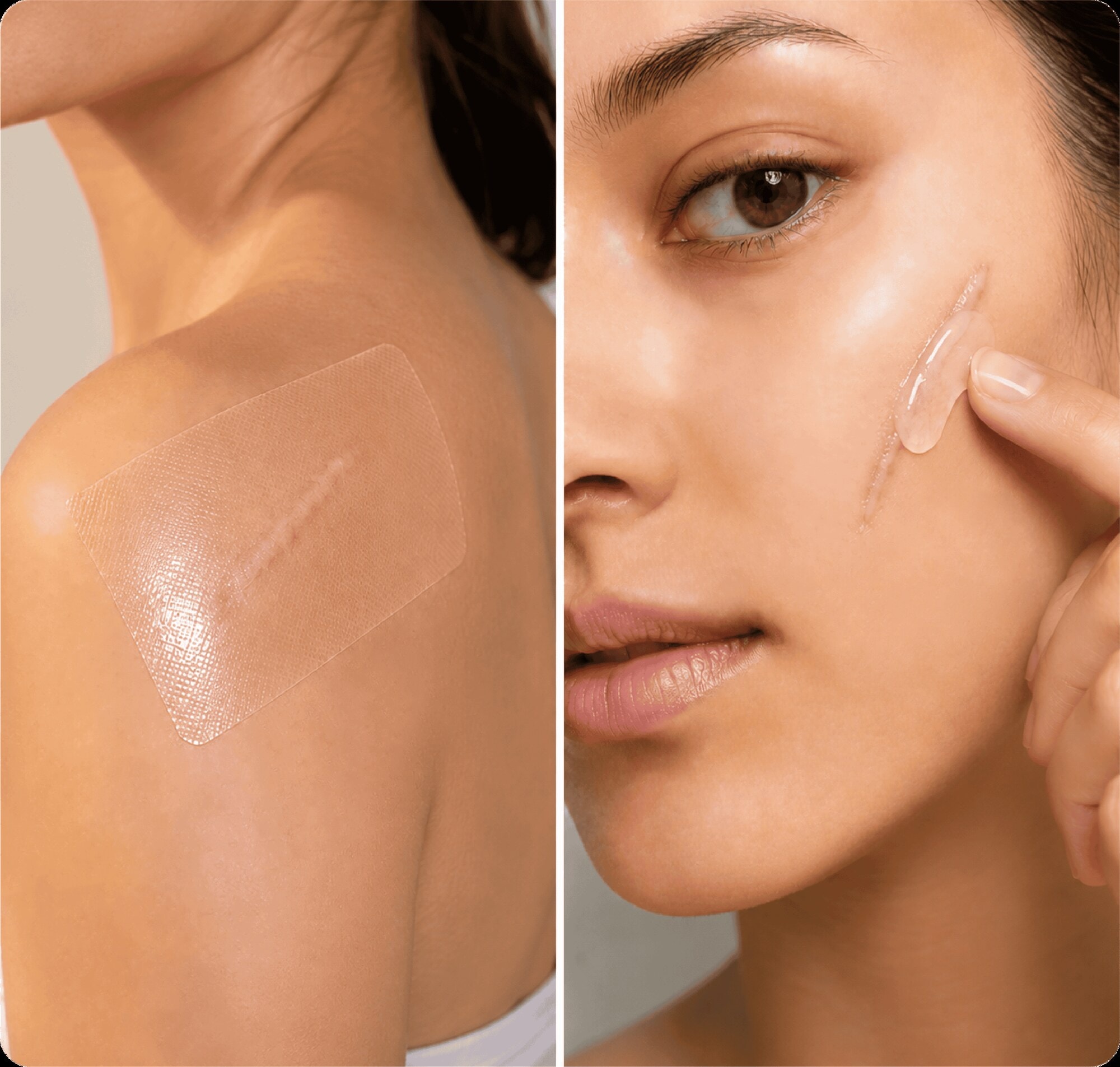 Scar sheet on shoulder and gel on cheek